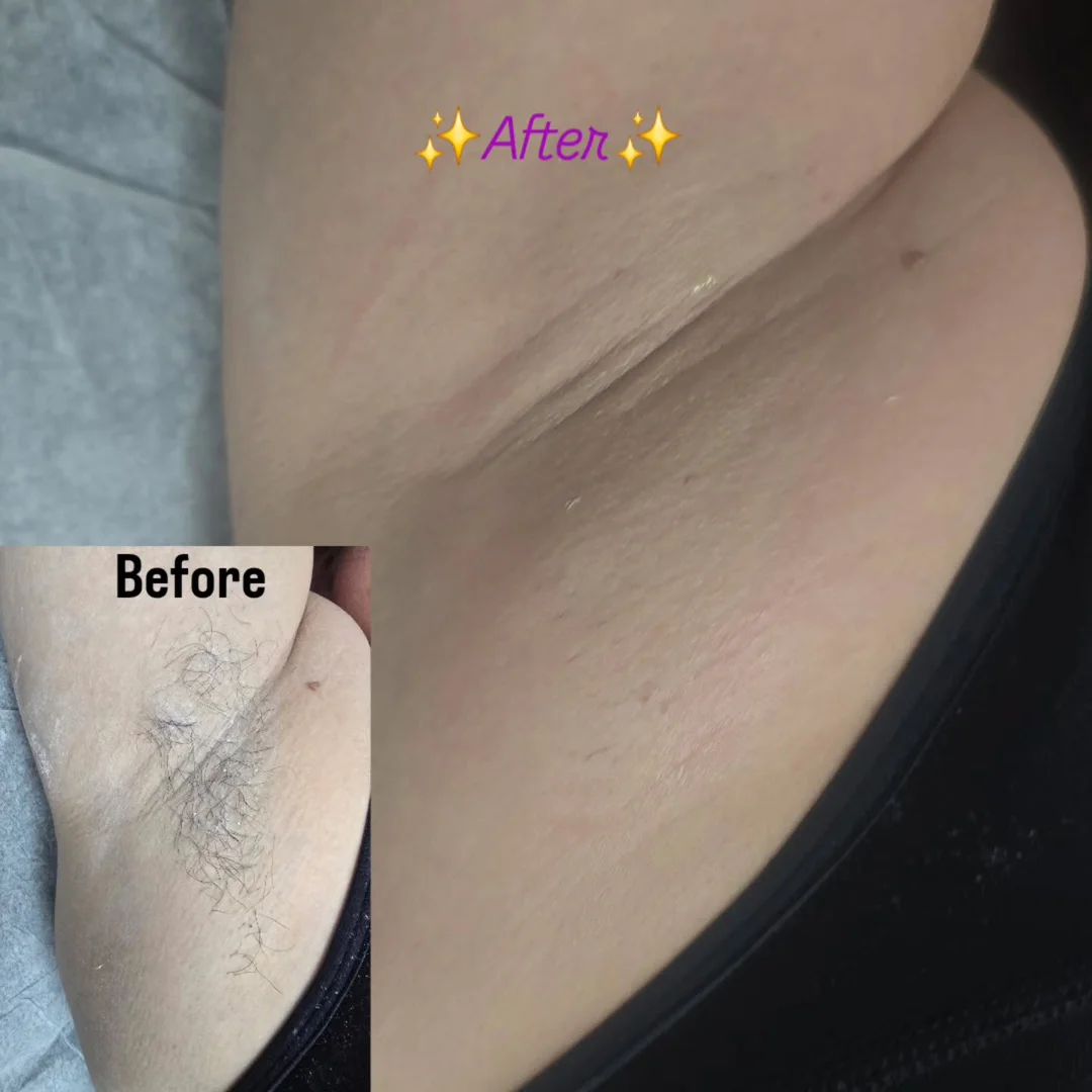 Smooth skin after waxing — before and after