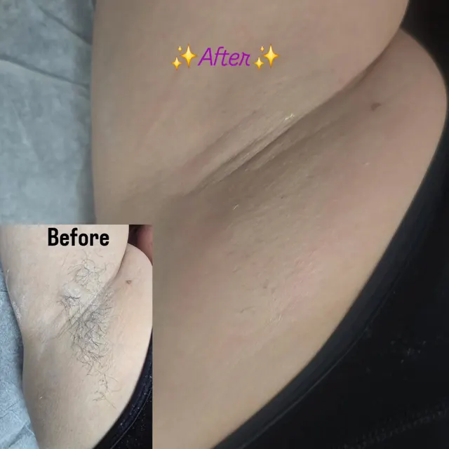 Smooth skin after waxing — before and after